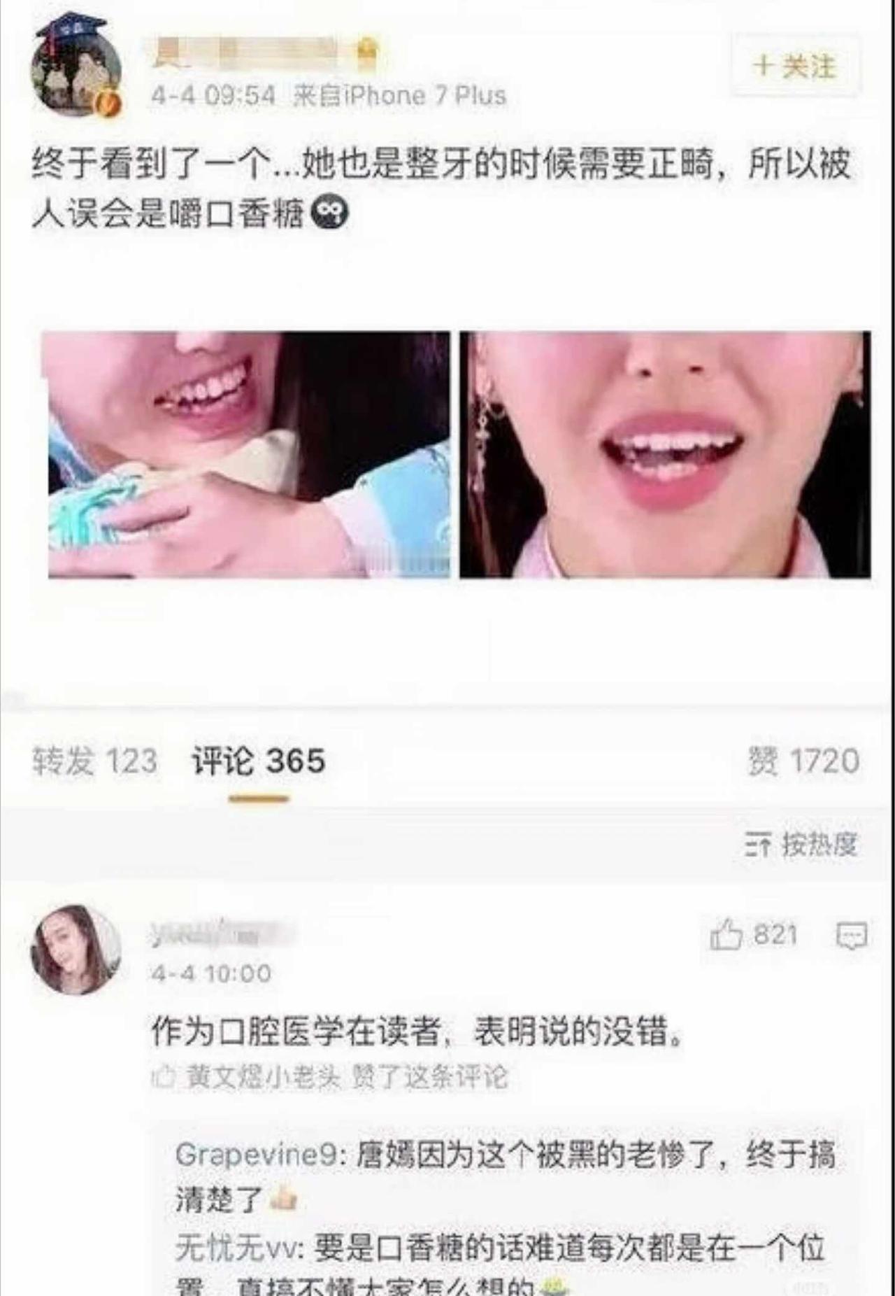 唐嫣 口香糖？？
唐嫣唐嫣同款谣言明星女演员女明星明星不止AB面 牙合垫牙齿矫正