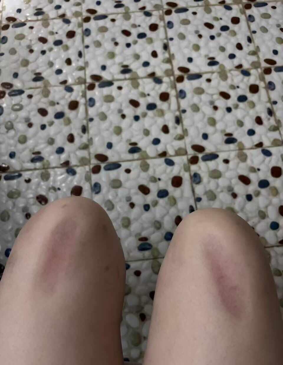 希望自己快点好起来 身体健康才能好好活着 治疗 癌症 虞书欣 赵露思 三角洲行动