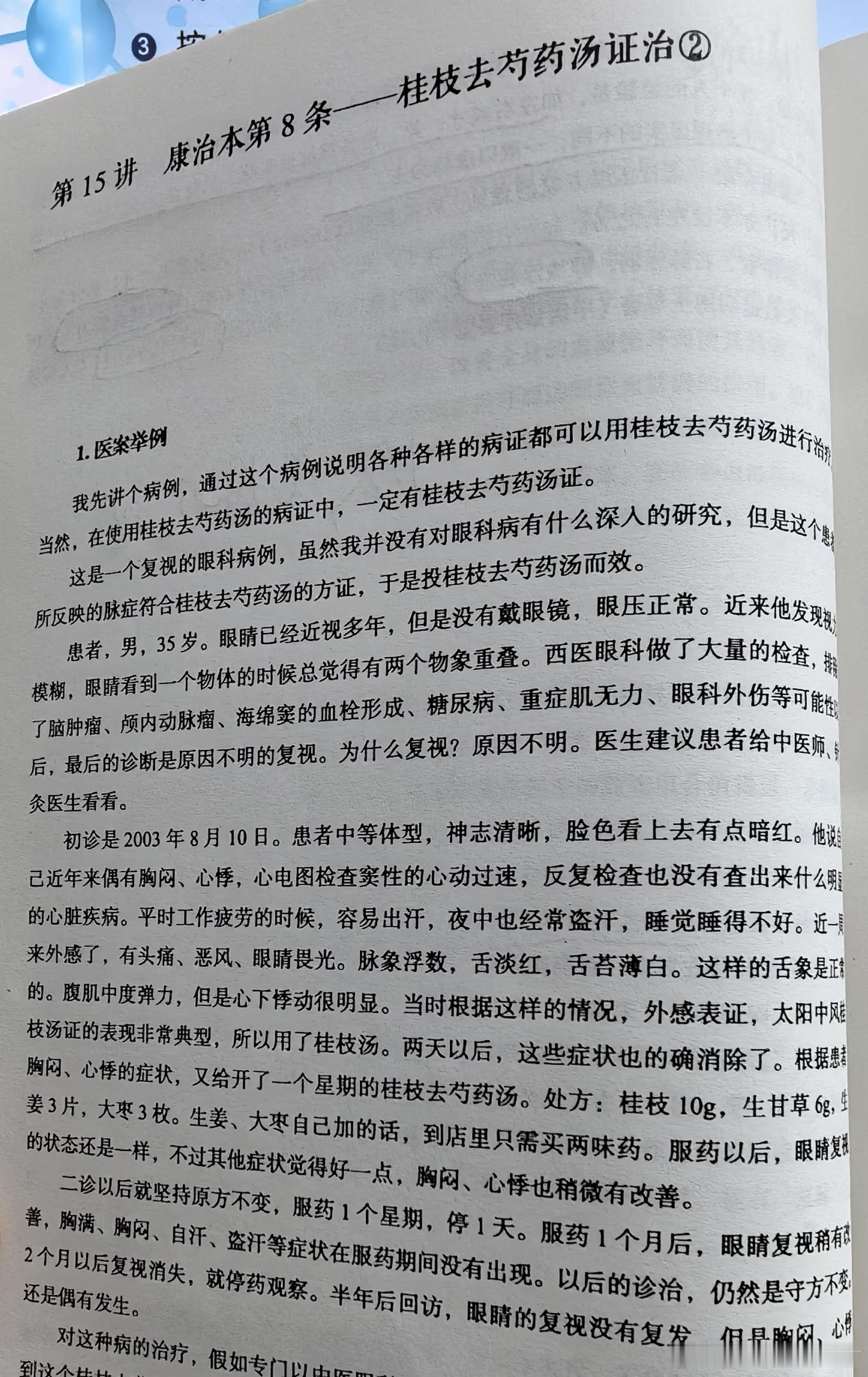 娄绍昆小剂量桂枝去芍药汤，2月治愈不明原因的复视（看东西时有重影）。依据是：易出