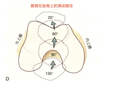 膝关节损伤 膝盖疼的朋友看过来——我们的髌骨，在股骨滑车上滑动，就像火车在轨道上