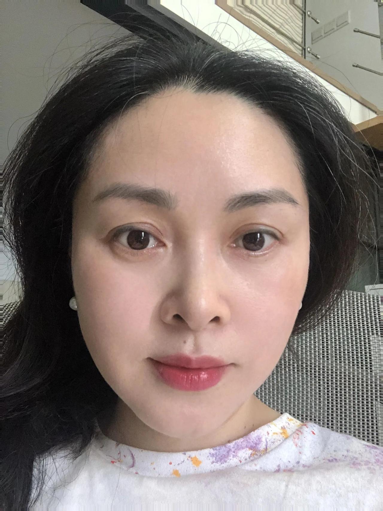 44岁，做了11年的红茶敷膜，皮肤像34岁！前几天，一起跳舞的伙伴对我说，好羡慕