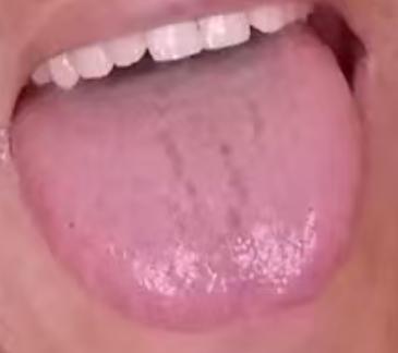 精力不振？中医扶正通络，恢复身体状态







很多朋友年纪轻轻就出现了房事