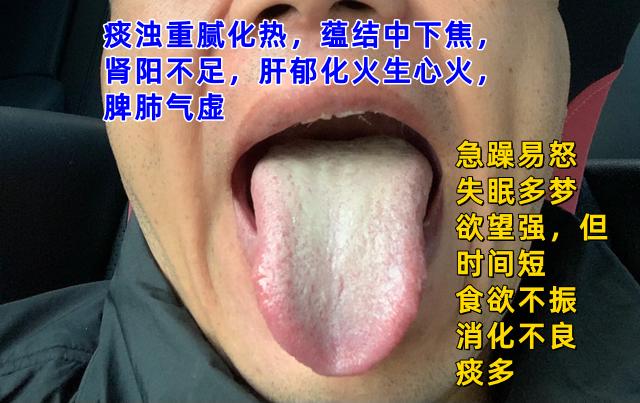 现在不忙，抽空来看大家分析舌象：

只要你发，李医生在空闲之余都会尽最大努力，来