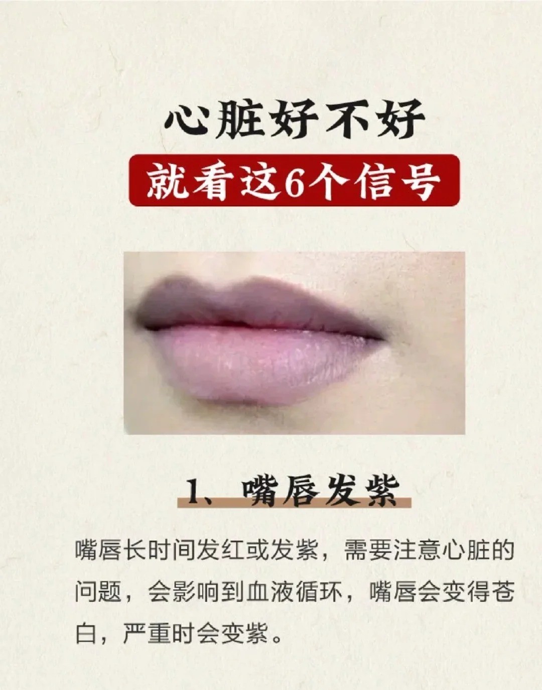 嘴唇发紫博主称一直以为身体正常 嘴唇发紫可能是心脏或肺部疾病的信号，别只当是体质