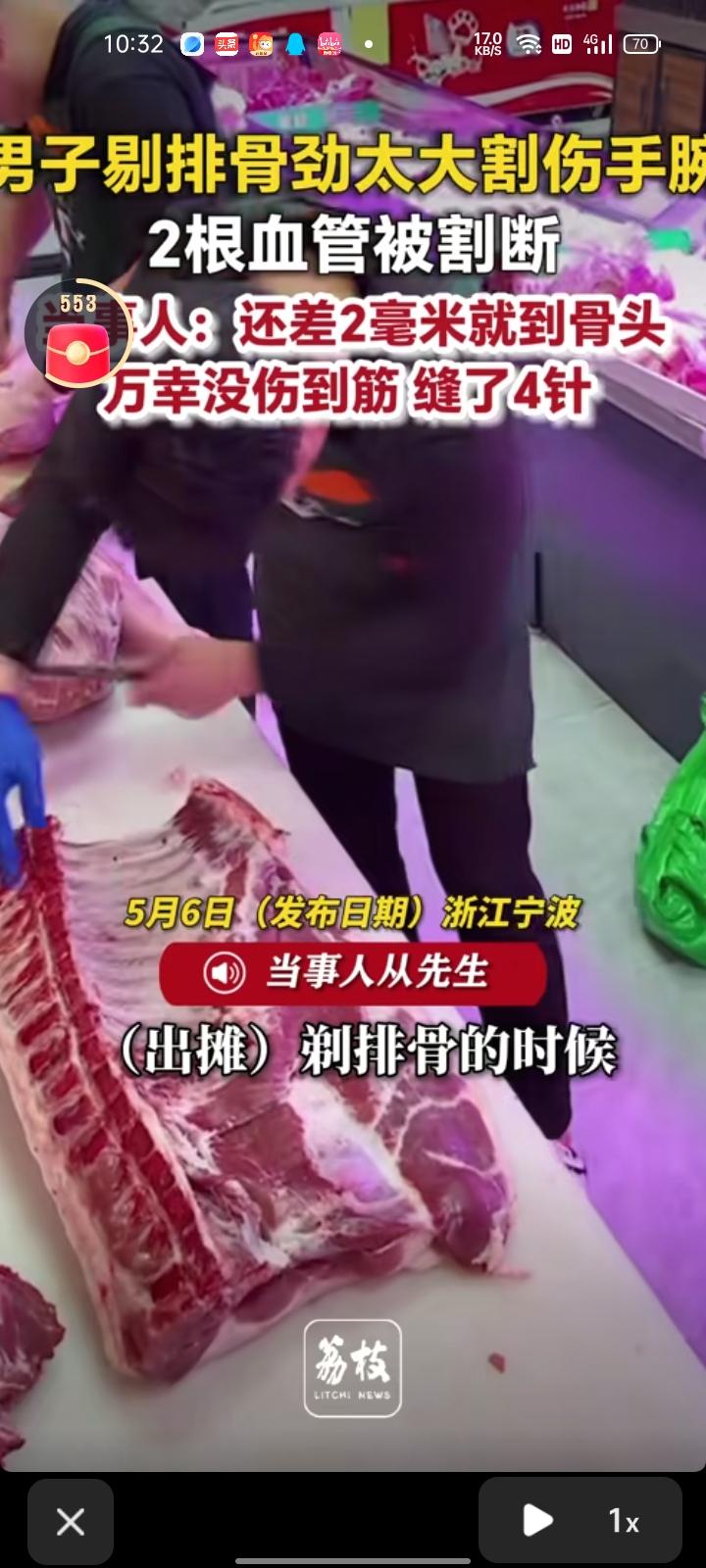 5月5日，浙江宁波。00后小伙创业摆摊卖猪肉，剔排骨时用劲儿太大割到手腕，两根血