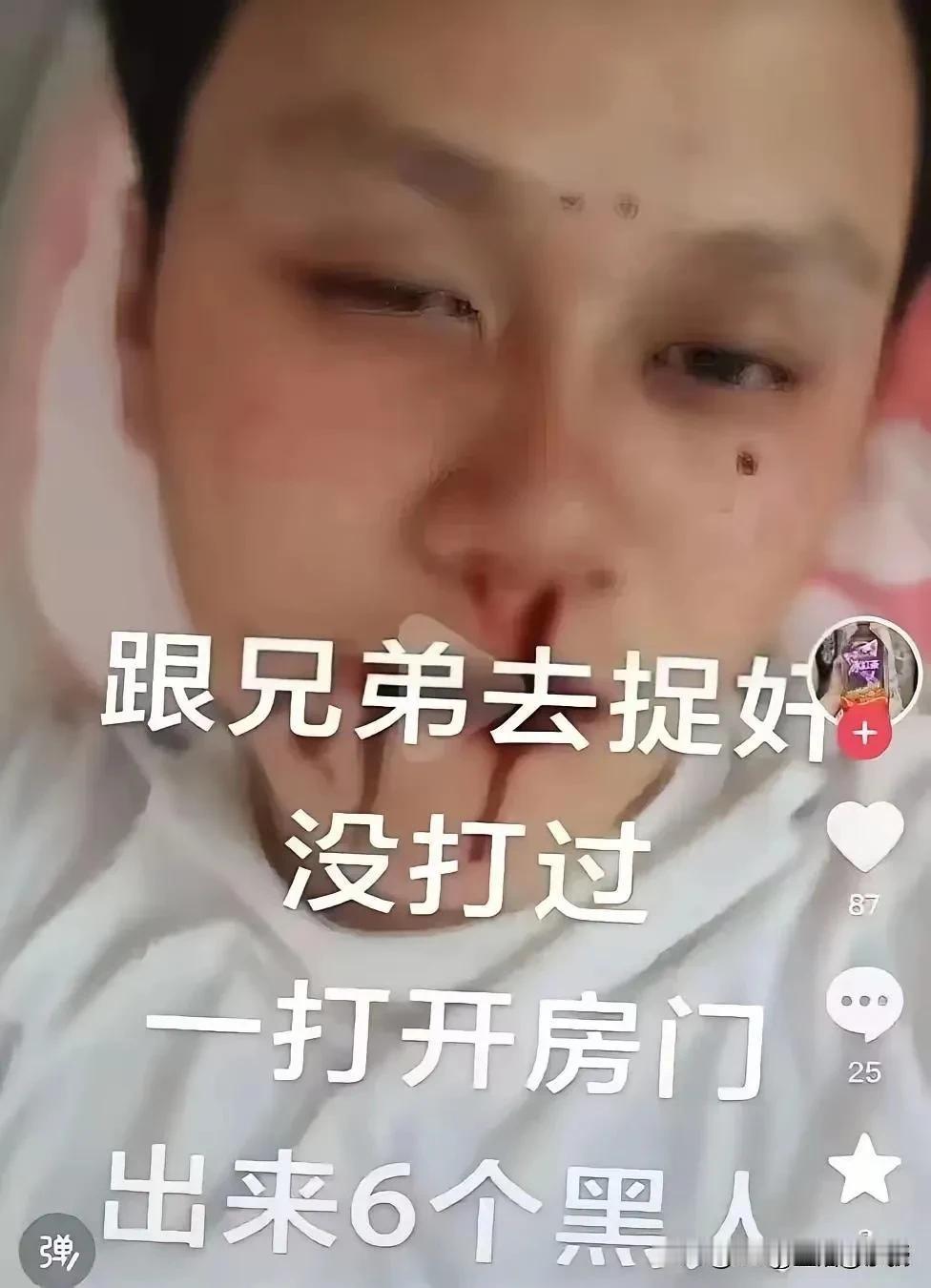 上次哥们也是捉奸，刚把门打开，出来6个黑皮肤的彪形大汉！但是我哥们没有被打，只说