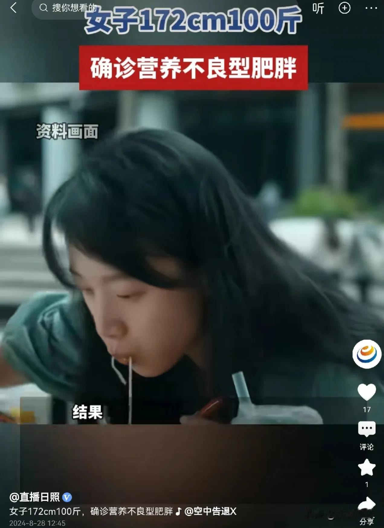 #女子172cm100斤确诊营养不良型肥胖# 女子虽然看上去瘦骨嶙峋，她身高一米