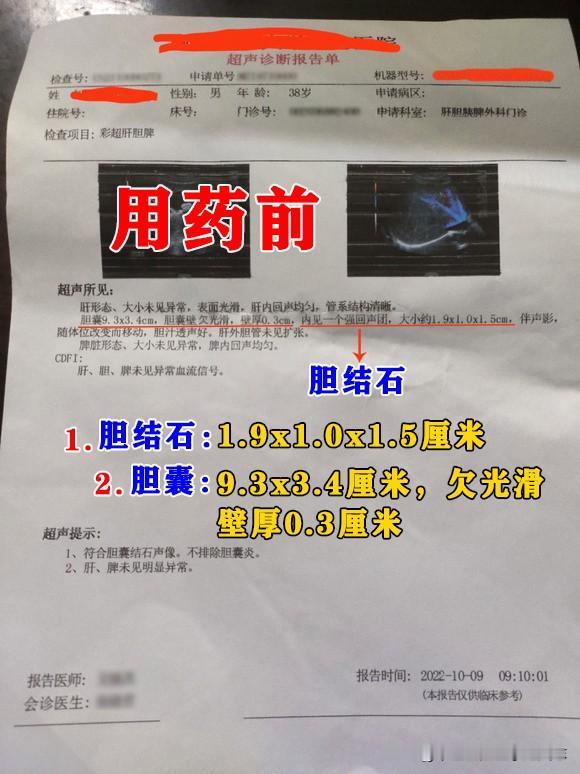 这位患者是一位男性，38岁，患者就诊的时候，拿着检验报告单，报告单显示胆囊壁欠光