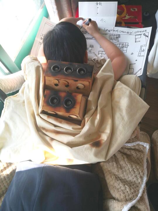 艾灸鼻涕鼻塞打喷嚏鼻炎