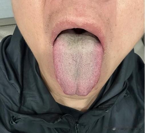 糟糕，实在糟糕，你这身体真的很差劲[吃瓜群众][吃瓜群众][吃瓜群众]
大哥主诉