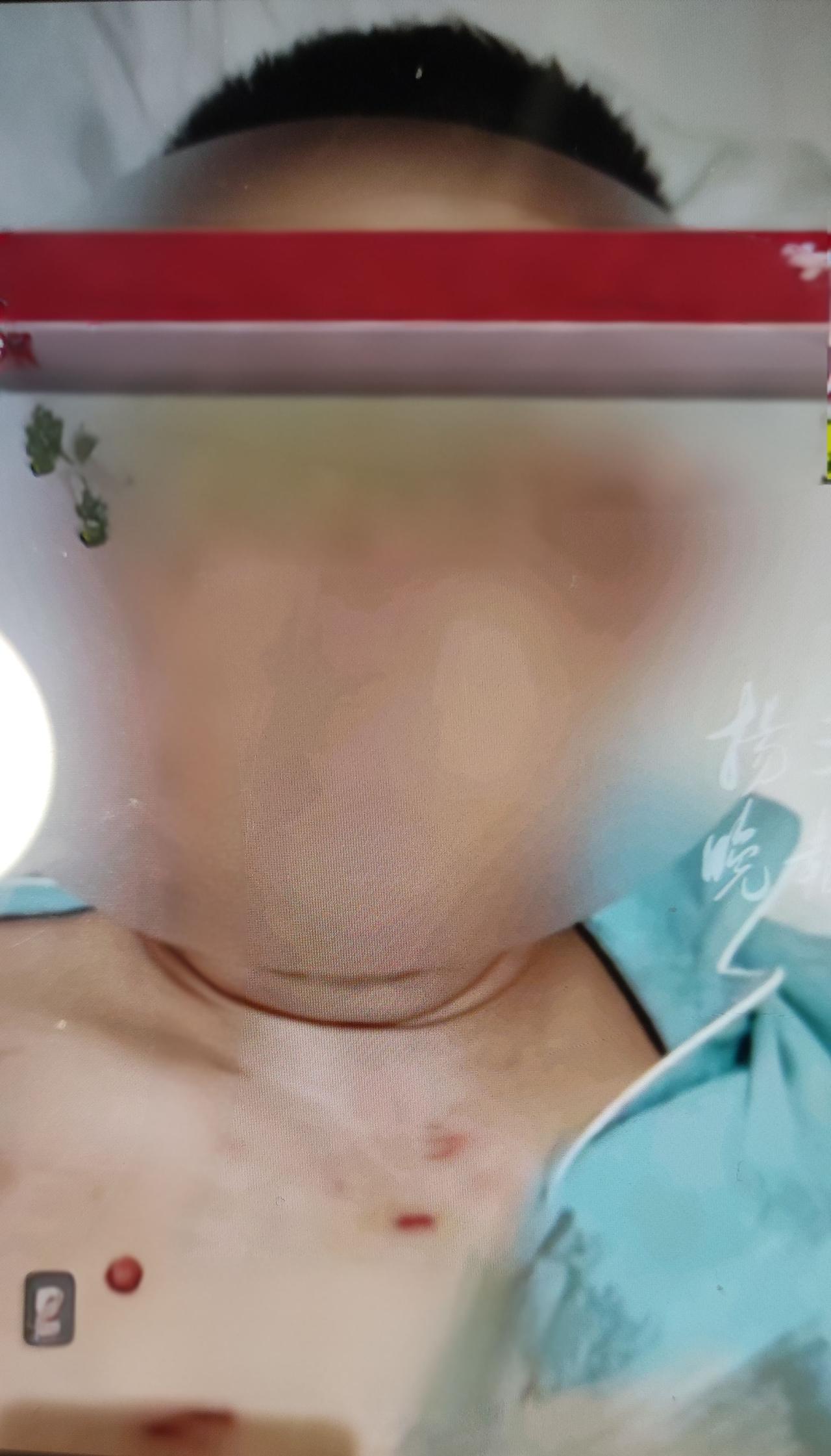 男子取款170万，被打成重伤二级！伤残八级！

24年7月2日，河南郑州倪先生去