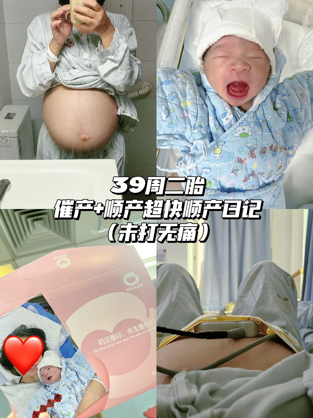 39周二胎省妇幼保健院催产，无无痛超快顺产