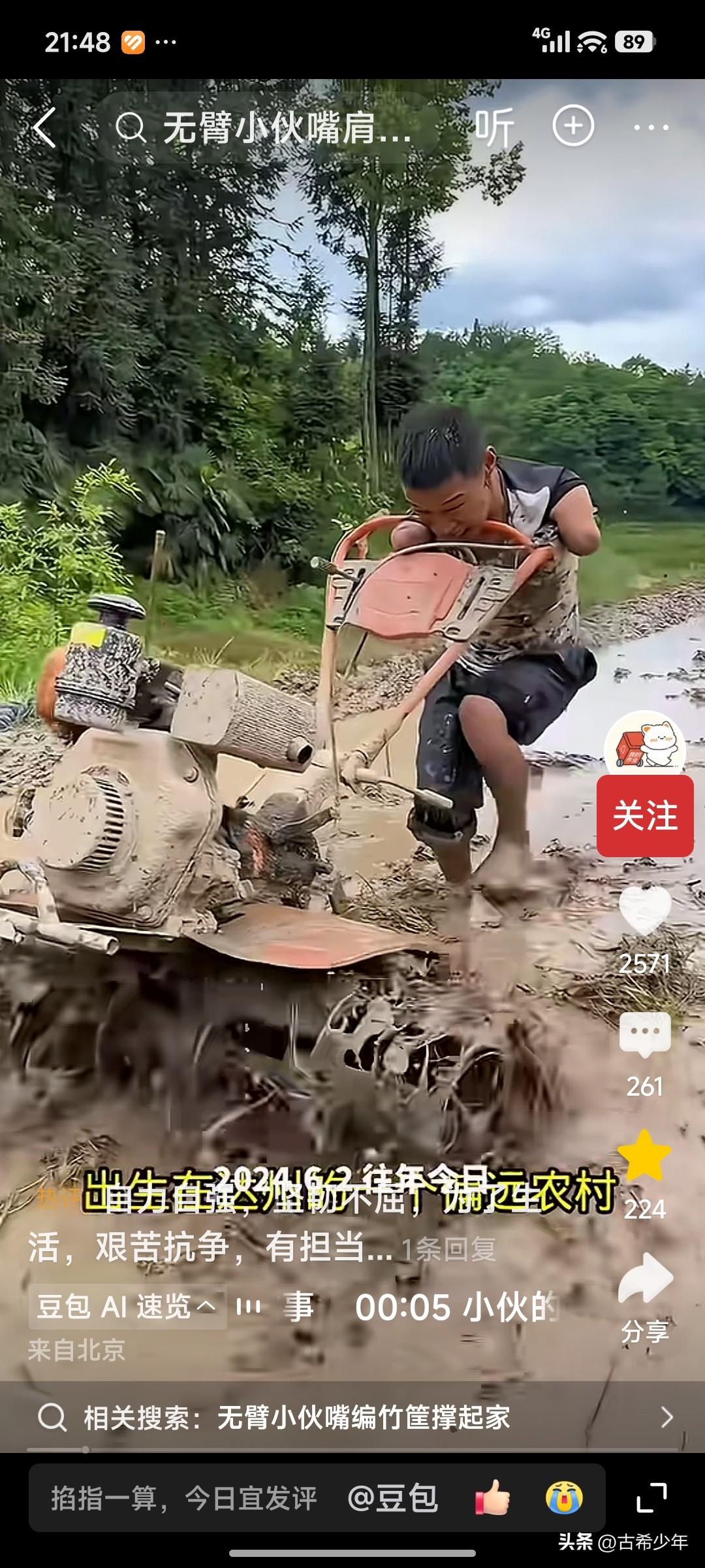 比起徐富贵，你还有脸叫苦叫累吗？
 
四川达州有个男人，2008年二十岁时被高压