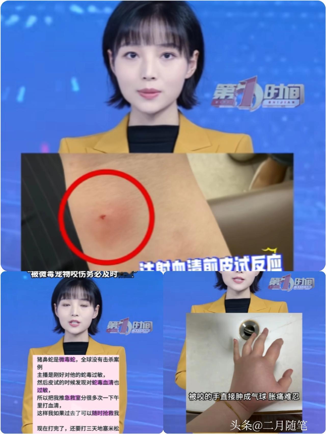 惊魂一刻！
江苏一女生在家饲养了一条宠物猪鼻蛇，却因疏忽连续三四个星期没有给蛇喂