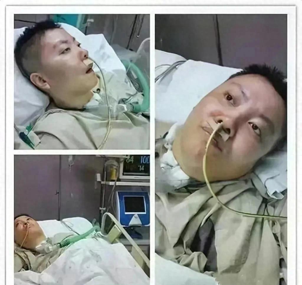 那会儿大家只知道她病得厉害，头发掉光，手脚发麻，没人想到是铊。医生说没接触史，清