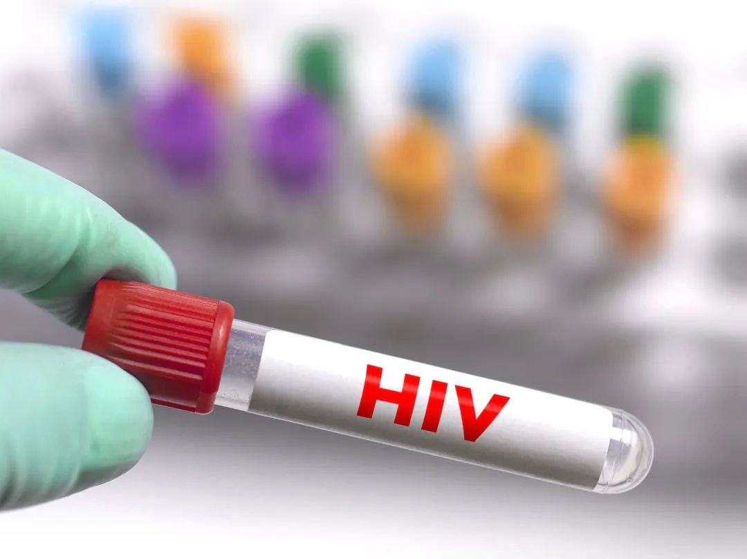艾滋病 隐私1980年代美国强制报告HIV感染者信息，导致：检测率下降40%高危