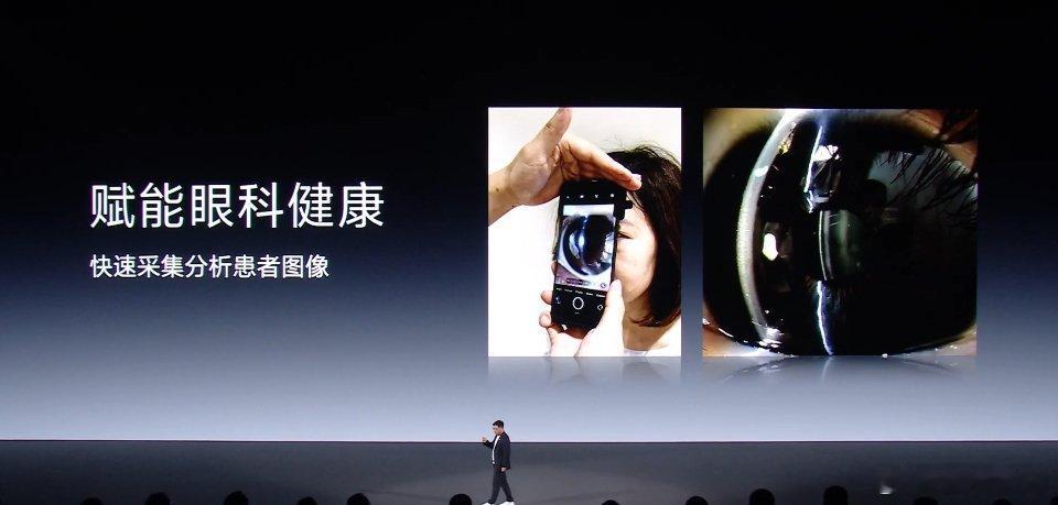 未来 vivo 还将推出便携式专业裂隙灯，实现 50MP 甚至更高像素，赋能眼科