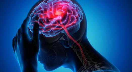 【研究发现：血型与早期中风风险相关。】根据发表在《神经病学》（Neurology