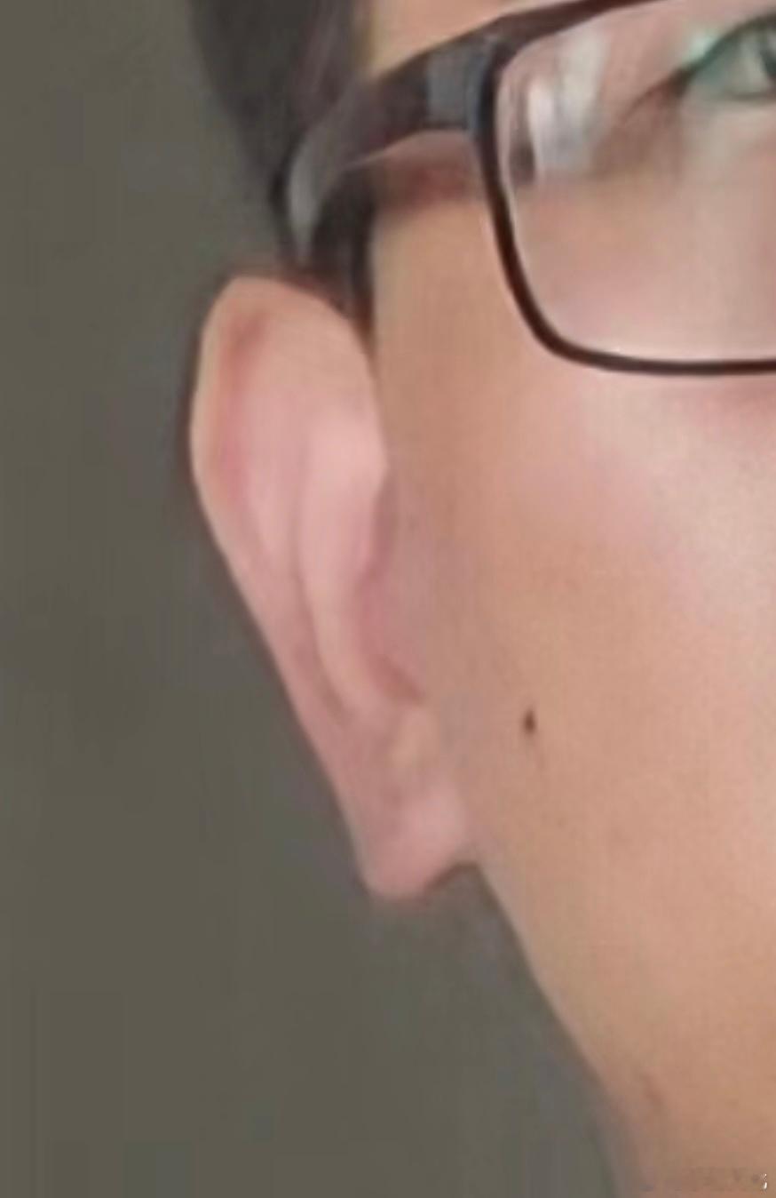 面相一则：[并不简单]男士耳朵长，但薄，且耳骨浅、无力的，此为喜欢吃软饭的耳朵。
