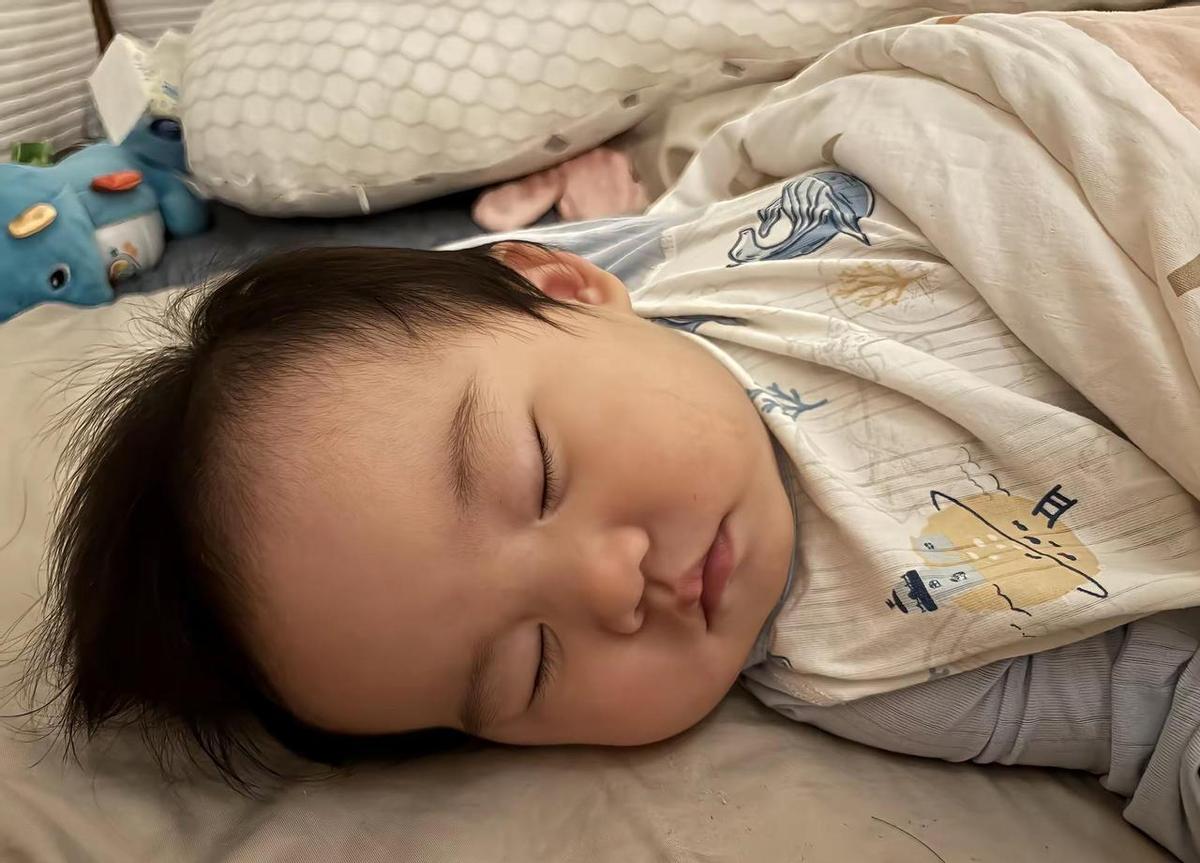 产钳留下的疤，不是夏天一晒就没了。
那不是胎记，是硬伤。
别听老一辈说“过阵子自