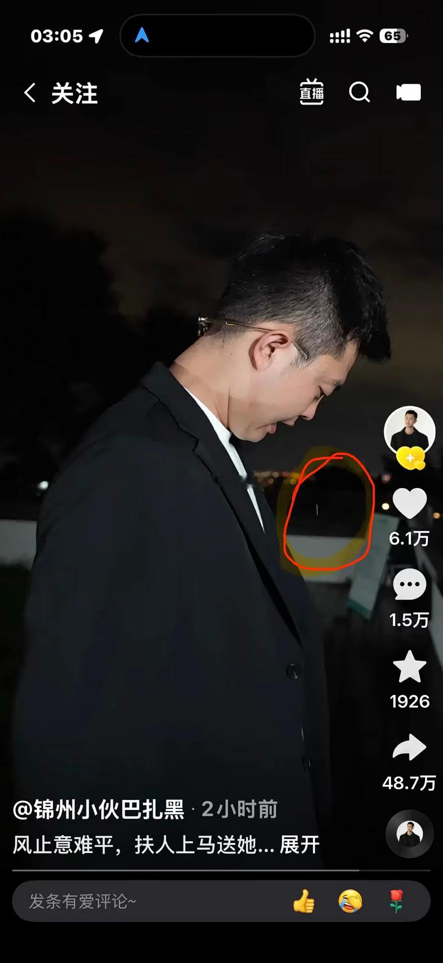 其实已经泪流满面了，因为有滤镜看不到，这一次扎黑真的伤到了