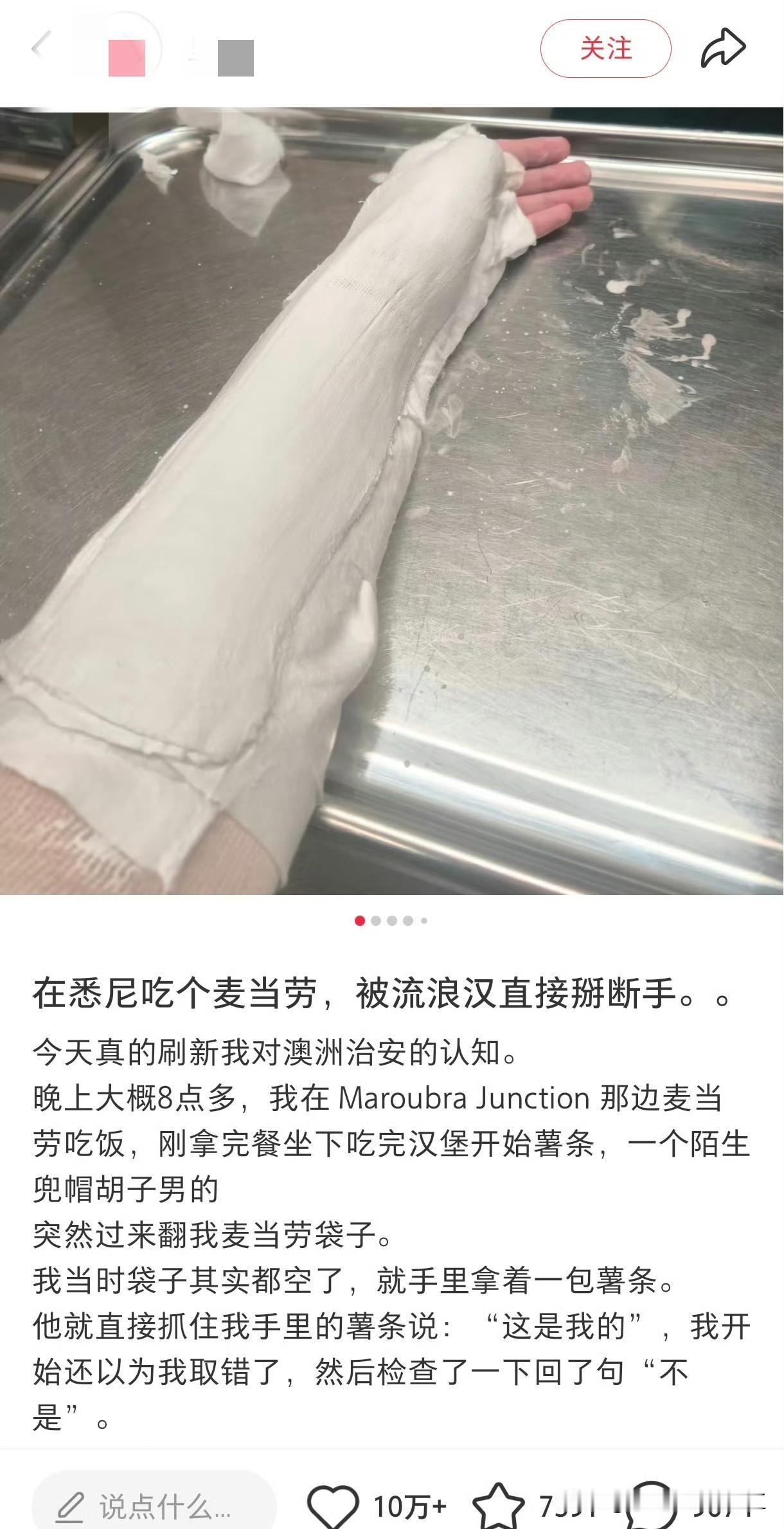 中国女留学生在悉尼麦当劳被流浪汉掰断手指，这在国内立马上热搜了吧！