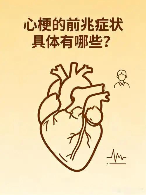 长久以来，我一直存在一个认知误区，总觉得心梗发作必然是胸口传来剧烈难忍的疼痛感，