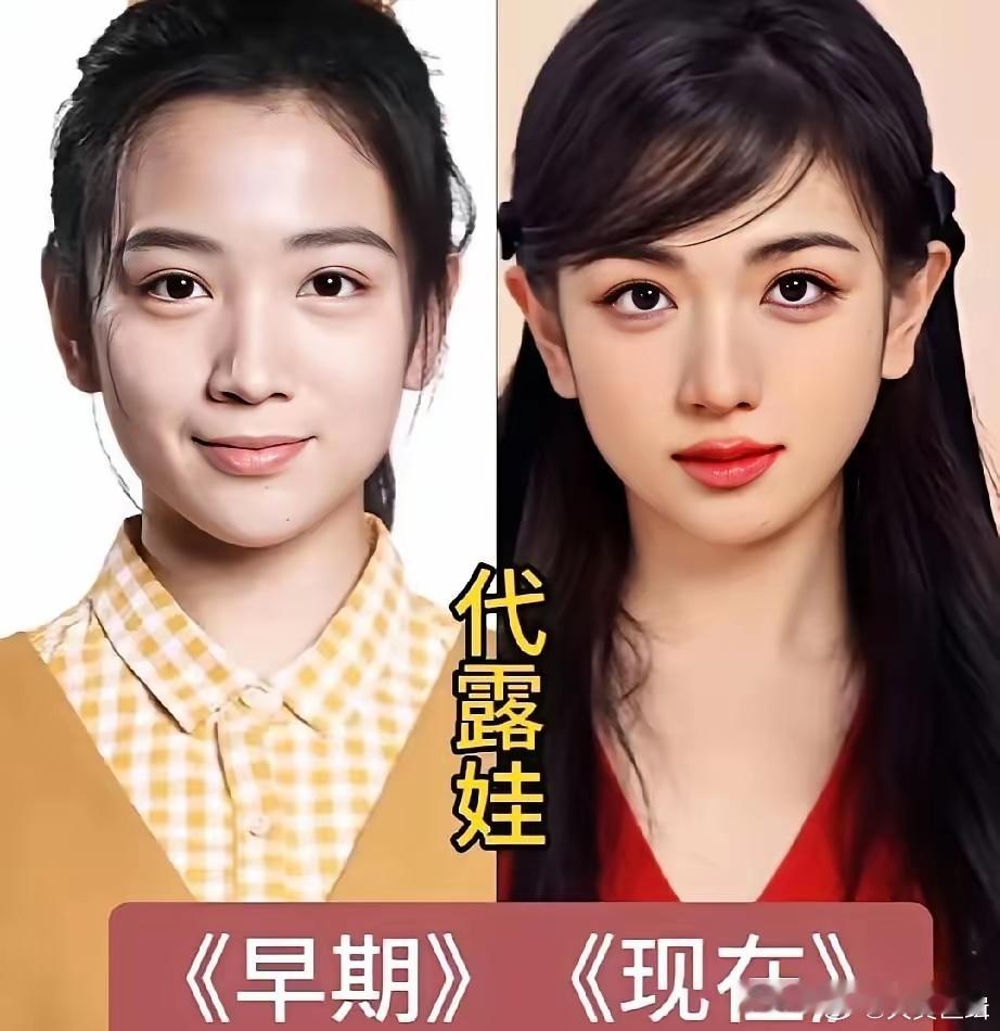 5 位当红小花早期vs现在颜值对比，有人“换脸”成功，有人只是瘦了虞书欣是从“普
