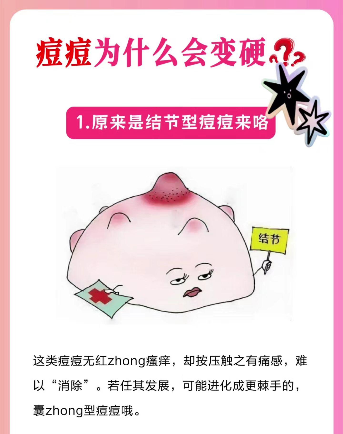 硬块痘痘总是难好，原来是自己护理不当。痘痘肌肤痘痘