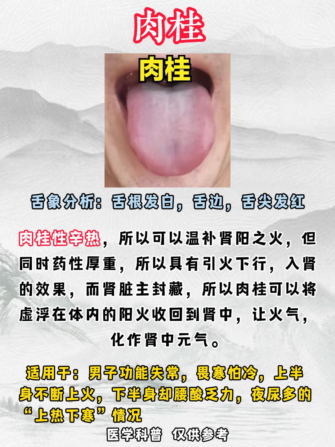 动不动就上火，心烦，还总是泻火无效，这多半就是虚火上炎了！
同样都是引火下行，肉