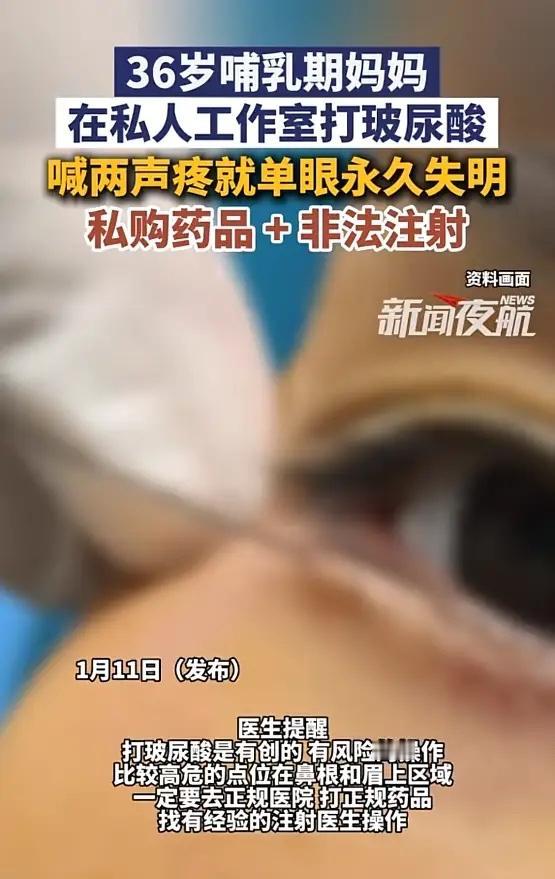 “太吓人了！”河南郑州，一女子为了变美，就去一家私人工作室打玻尿酸，在注射过程中