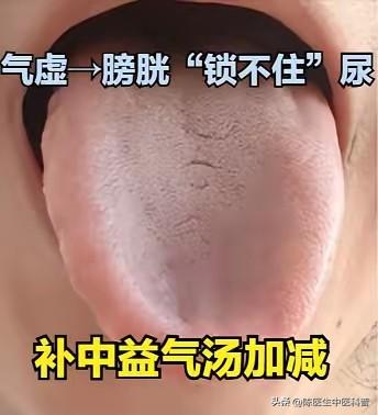 白天尿频=气虚！膀胱“锁”坏了，补气固尿才是根
 
提示：本内容仅供健康科普，不