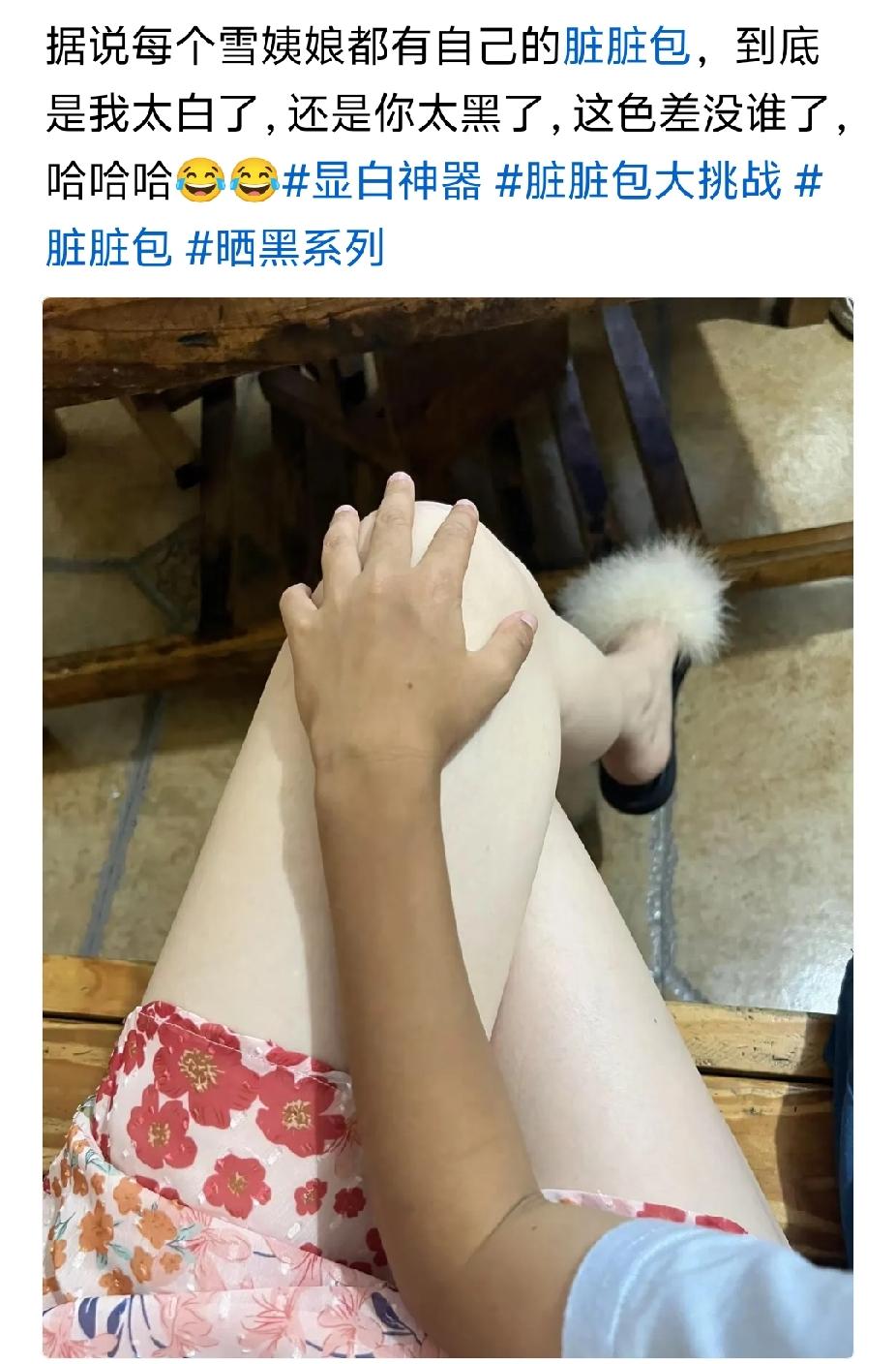 今天刚好坐公车，上来一农村妇女，四十多岁，一脸一手很黑又老，穿着外衣，车上热，她