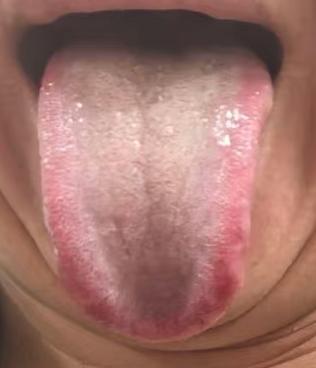 阳气亏虚引发精关不固？找对方向调养少走弯路






有位粉丝留言倾诉：自己一