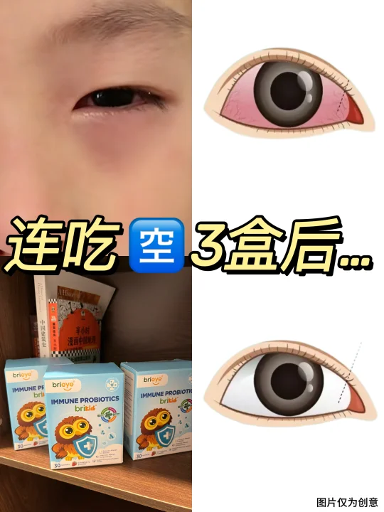 频繁挤眼睛揉眼睛❓内调很重要‼️
