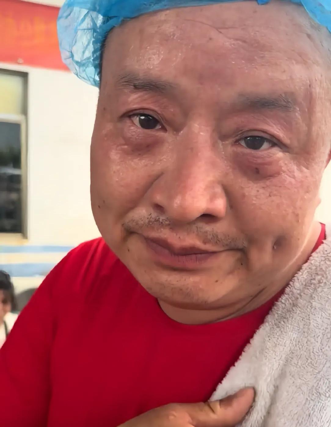 看见“烩面哥”这张照片
终于明白了
为什么“烩面哥”要选择拉黑父母，不是因为他伤