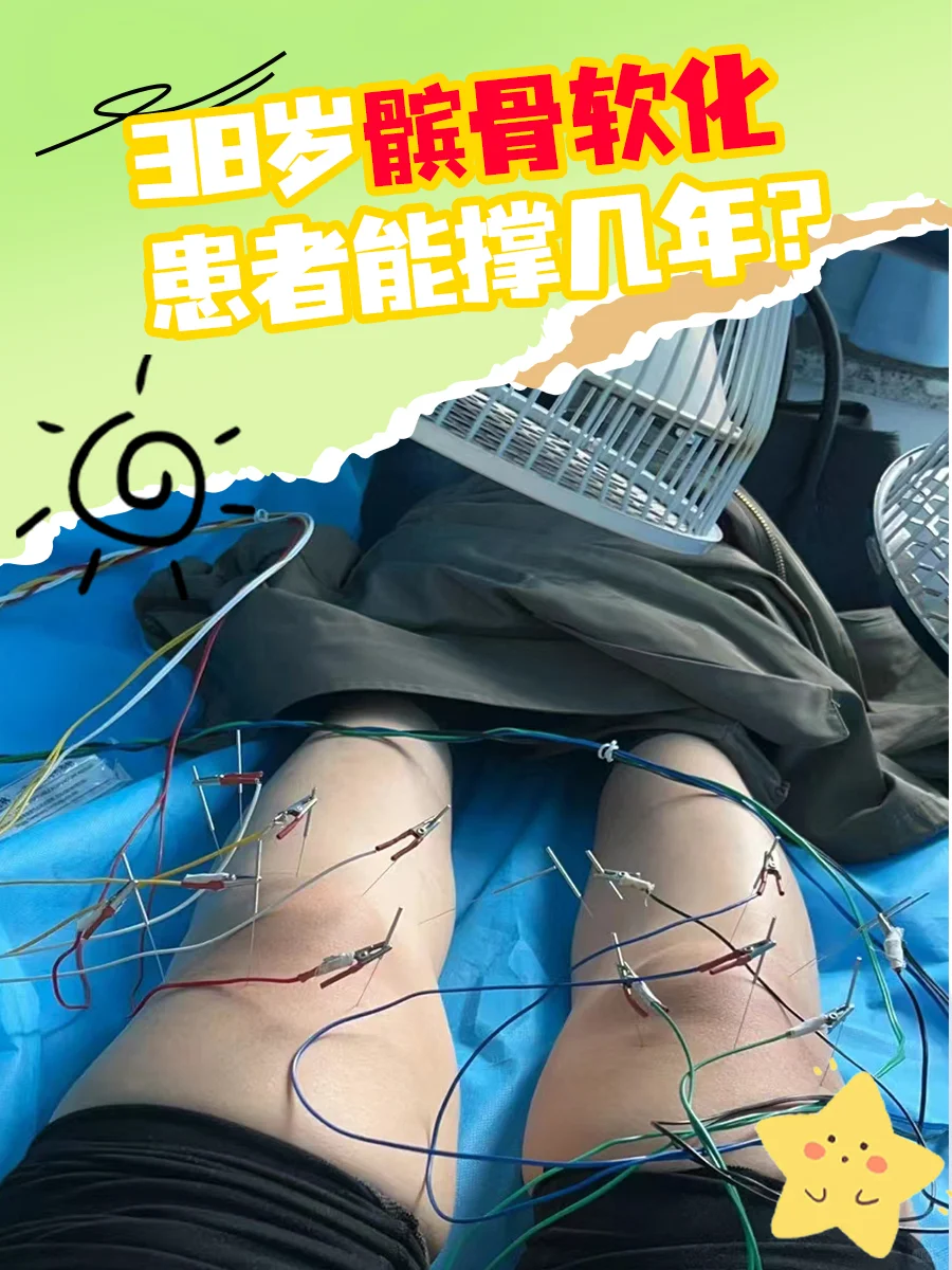 38岁髌骨软化症能撑几年