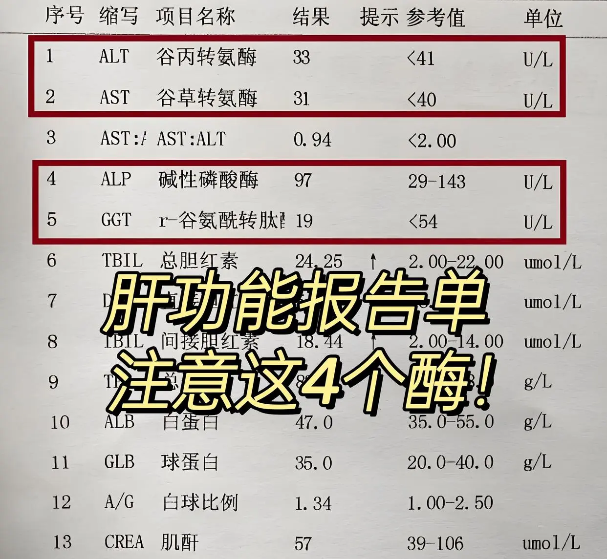 1. 谷丙转氨酶一种存在于肝细胞浆内的转氨酶，当肝病发生时，会让细胞膜...