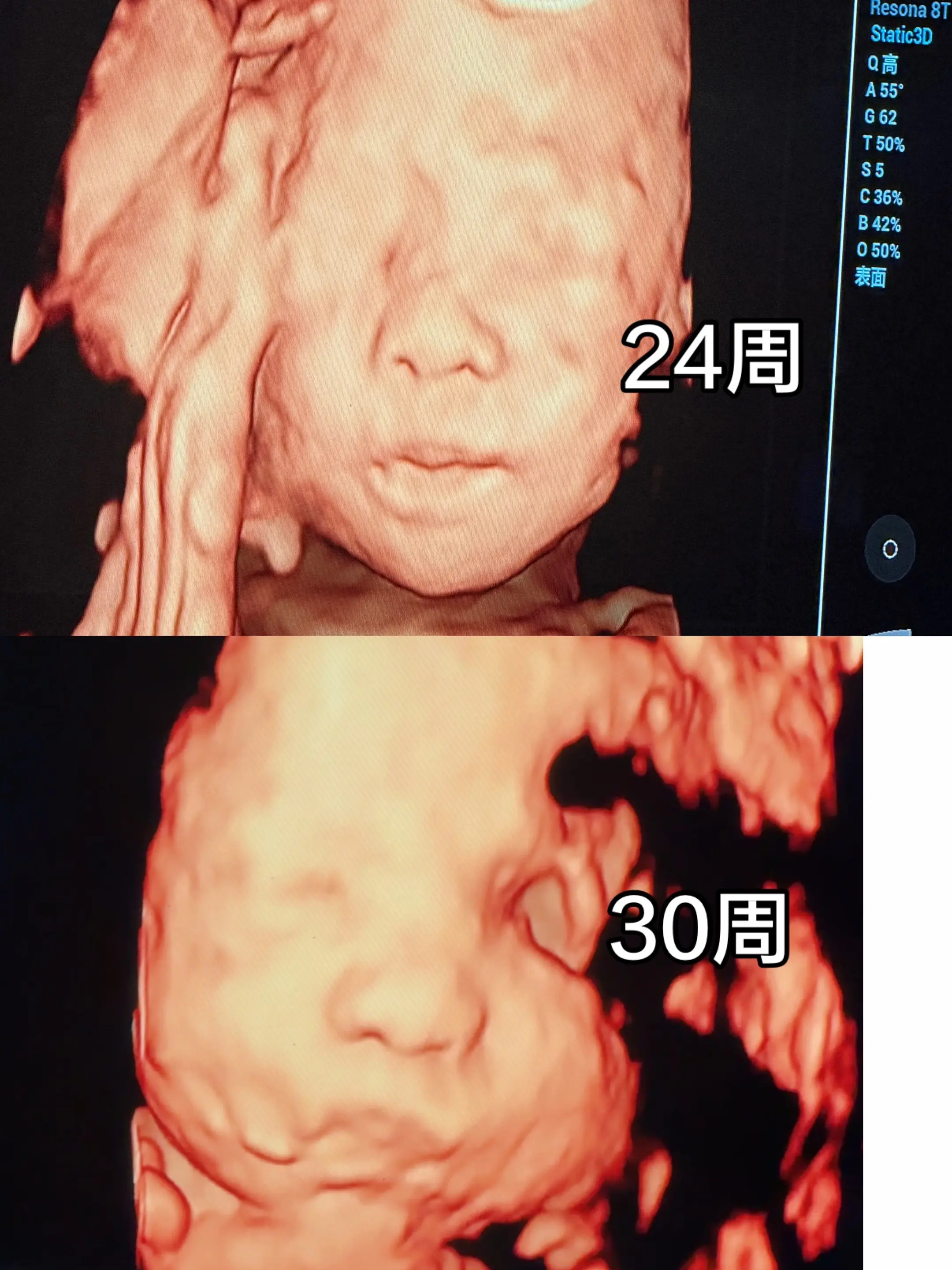 宝宝你的瓜子脸去哪里了😂😂。