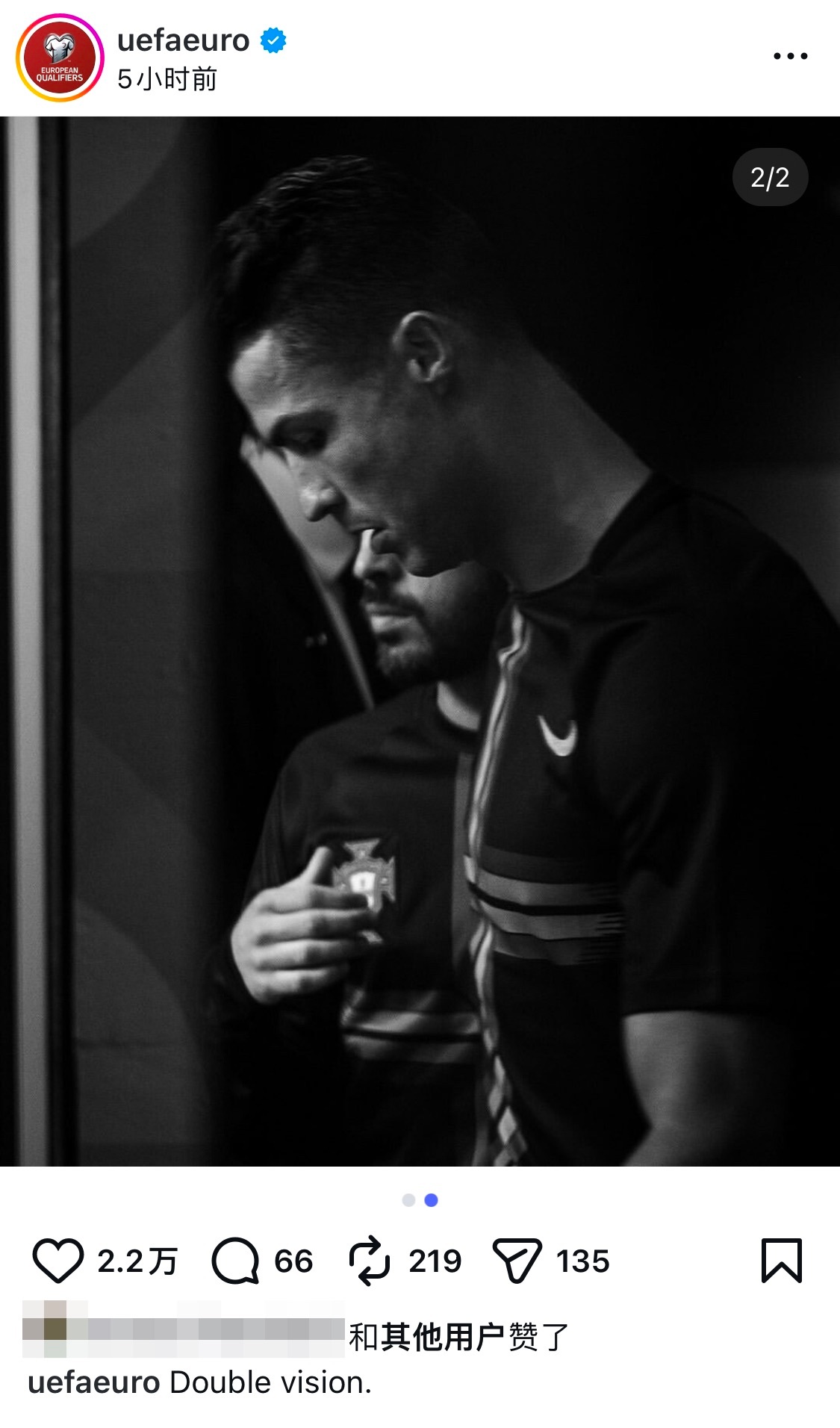 左脸 右脸哪一边脸都很完美