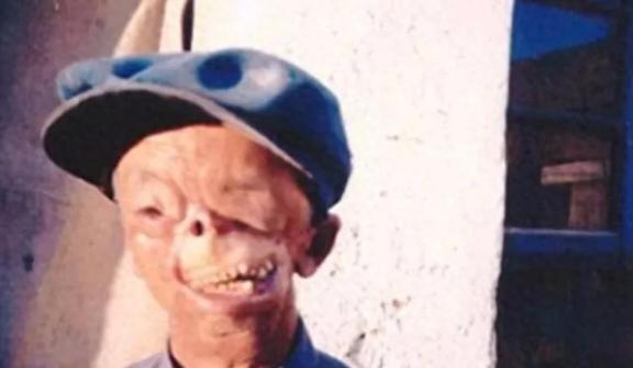 1950年，年仅3岁，就被狼咬掉了半张脸，父亲将其无情的扔到山洞中，没想到他却顽