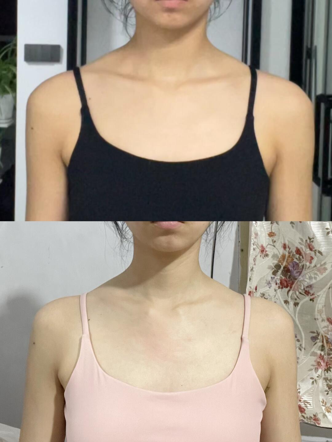 从上面改善到下面 是变好了还是变坏了❓