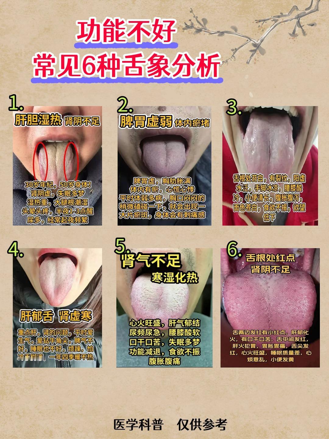 功能不好，“交粮困难”，病根不全在肾！6种常见肾虚原因，帮你一一分析

对照看看