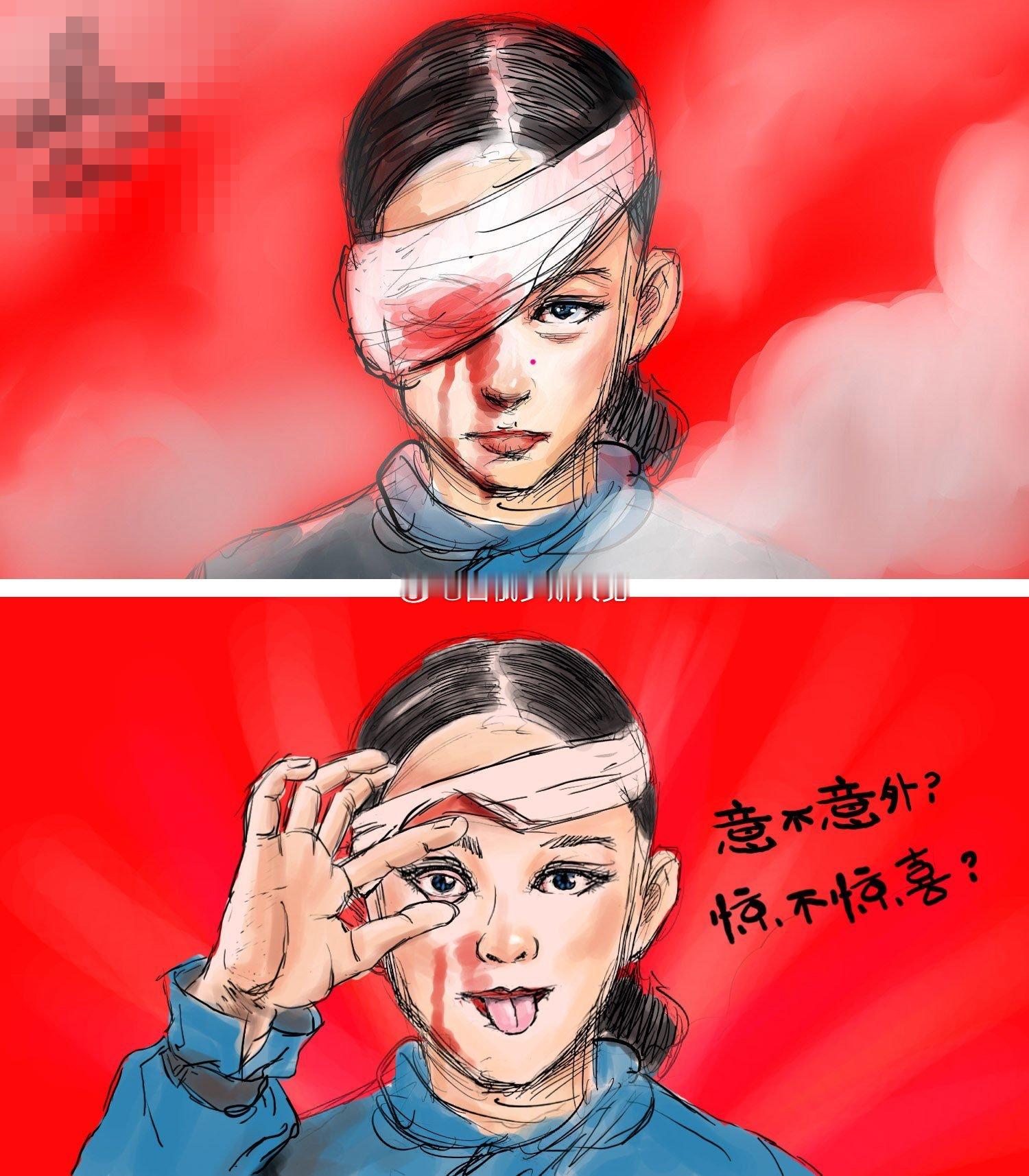 #爆眼少女眼没爆，去台湾了#2019年香港“反修例风波”中受伤并被香港反对派等炒