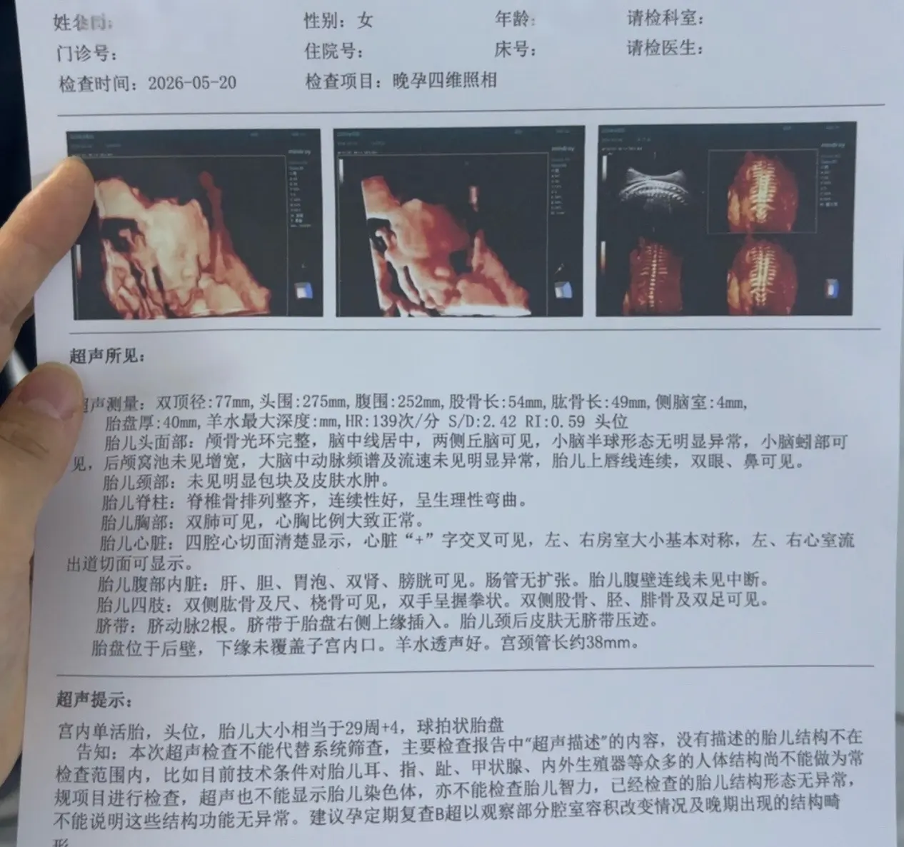 孕期产检。  顺利通过 ，进出两次，一切发育正常，也祝各位孕妈妈们产检一次通过✅