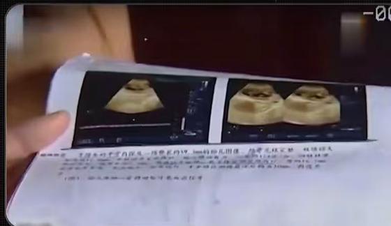 江苏 31 岁男子李磊，得知未婚妻吴秀秀怀孕后，非但没抓紧办婚礼，反倒打起了彩礼