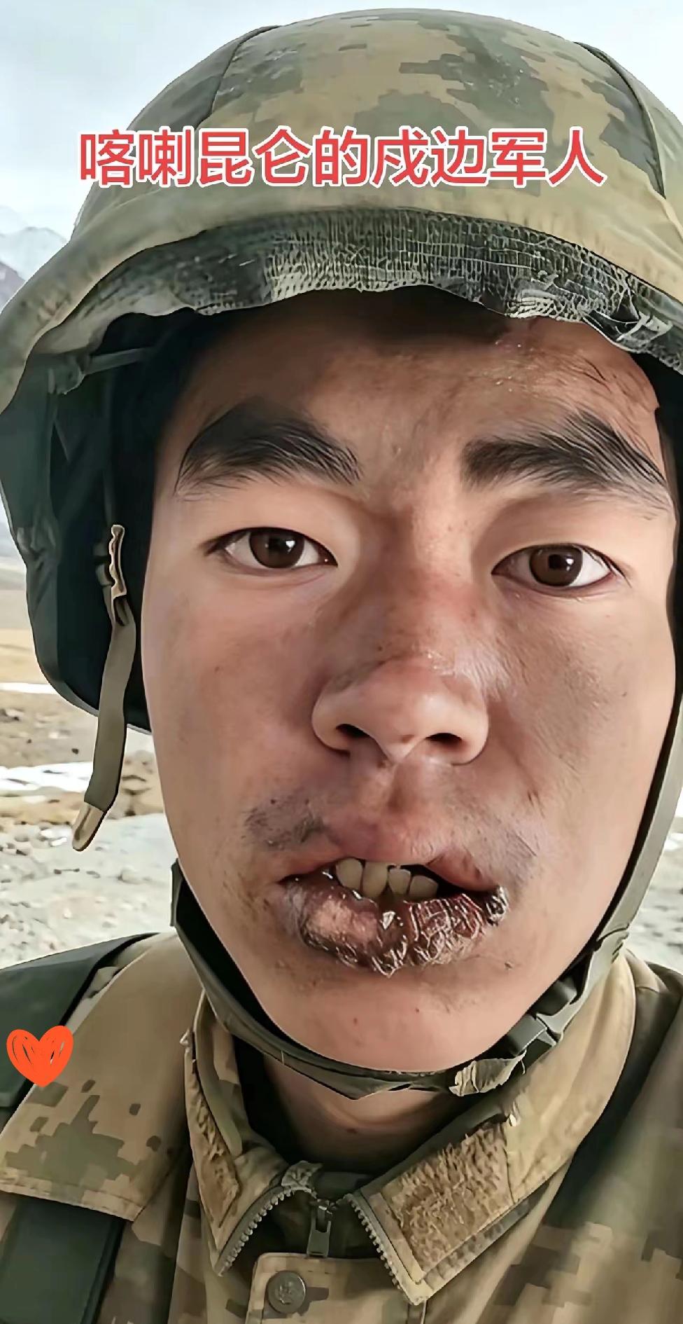 刷到喀喇昆仑戍边战士的实拍图，我盯着那道裂开渗血的嘴唇，鼻子一下就酸了。
海拔五