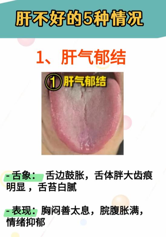 肝不好，身体会有这 5 种信号