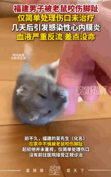 “知道鼠疫是怎么来的吗？”福建一位吴先生就因为被老鼠不经意间咬了一口脚趾，心脏里