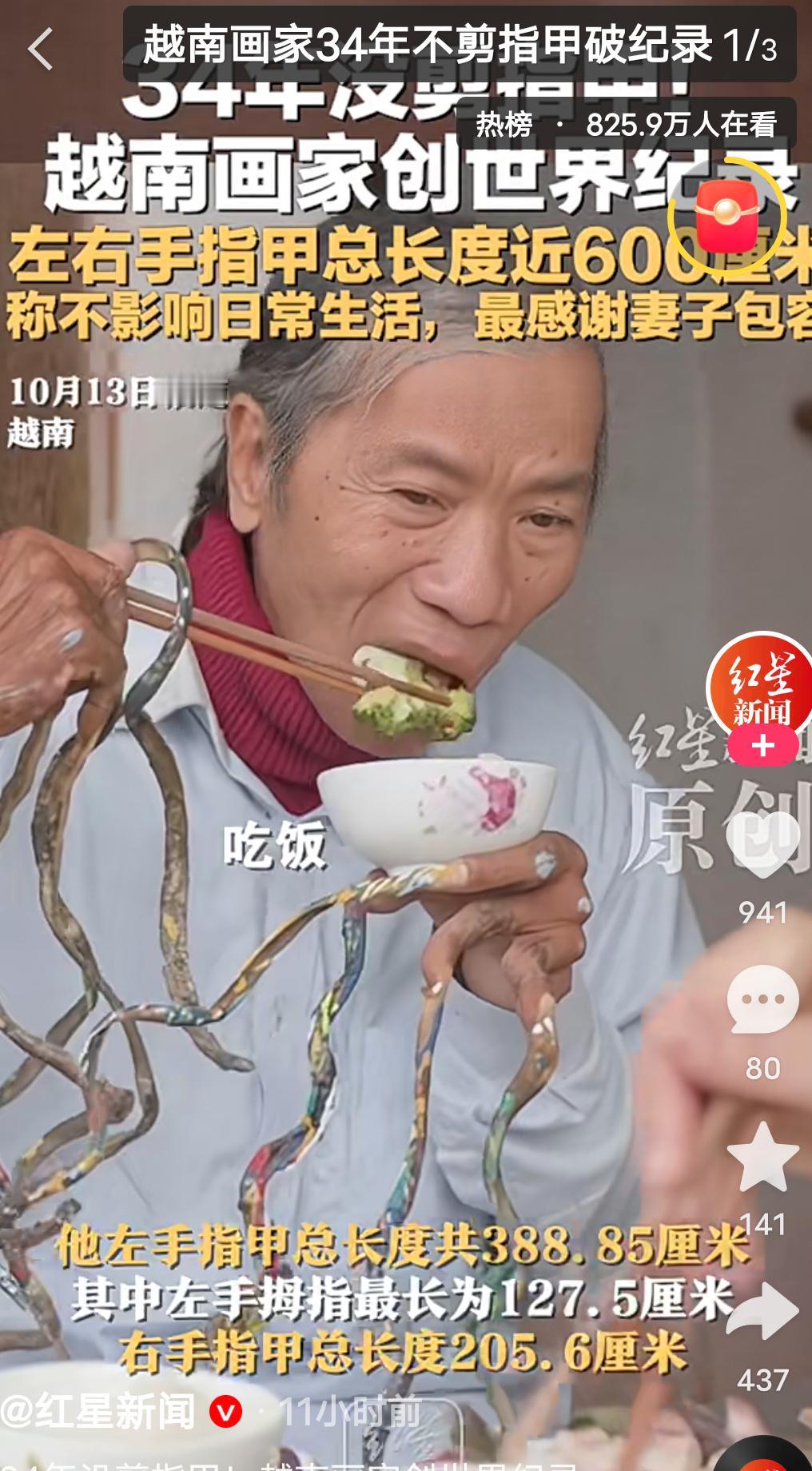真是个狠人！为打破世界纪录，他楞是34年没剪过指甲，如今，他的双手指甲加起来总长